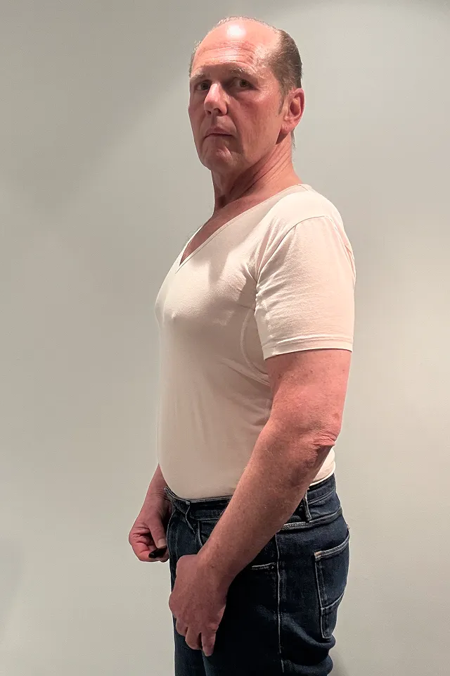 Markus nach 4 Monaten Behandlung