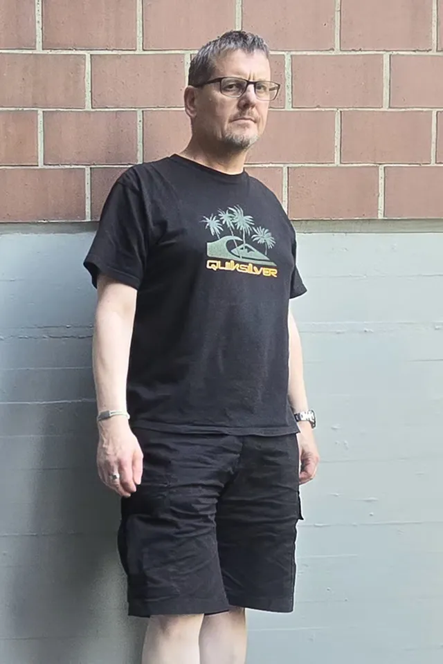 Philip vor der Behandlung