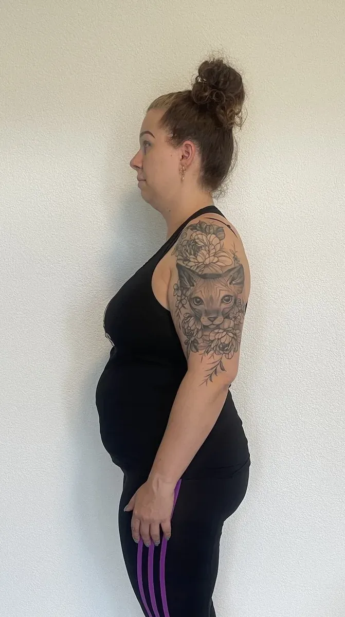 Sarah vor der Behandlung