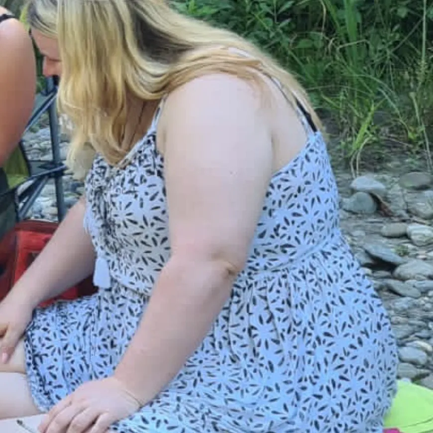 Saskia vor der Behandlung